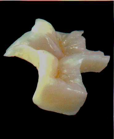 sthetische Zahnheilkunde